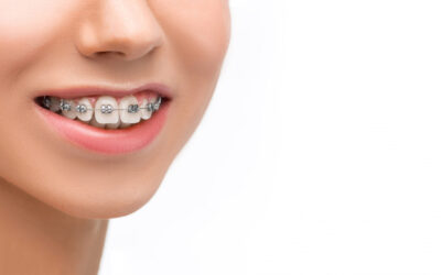 Ortodoncia: La clave para una sonrisa saludable y equilibrada