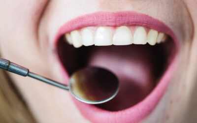 Periodoncia en Valencia: Cuida Tus Encías con Dentalgar